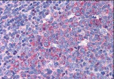 Immunohistochemistry-Paraffin: eIF5A Antibody [NBP1-51982]