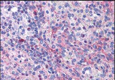 Immunohistochemistry-Paraffin: eIF5A Antibody [NBP1-51982]