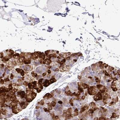 Immunohistochemistry-Paraffin: eIF5A Antibody [NBP2-38911]