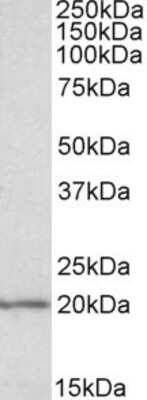 Western Blot: eIF5A Antibody [NBP1-51982]