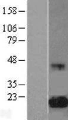 Western Blot: eIF5A Overexpression Lysate [NBP2-09679]