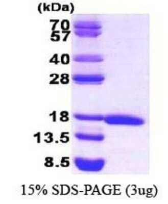 SDS-PAGE: Recombinant Human eIF5A Protein [NBC1-21053]