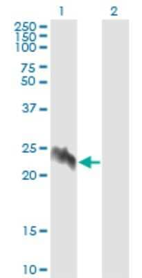 Western Blot: eIF5A2 Antibody (1E7) [H00056648-M01]