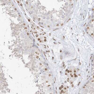 Immunohistochemistry-Paraffin: eIF5A2 Antibody [NBP1-85943]