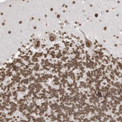 Immunohistochemistry-Paraffin: eIF5A2 Antibody [NBP1-85943]