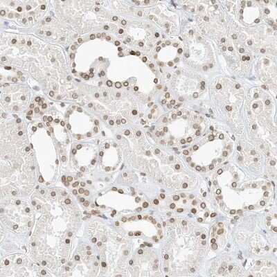 Immunohistochemistry-Paraffin: eIF5A2 Antibody [NBP1-85943]