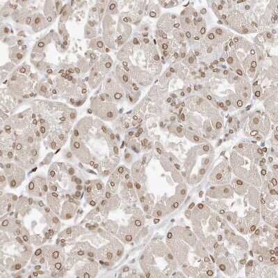 Immunohistochemistry-Paraffin: eIF5A2 Antibody [NBP1-85943]
