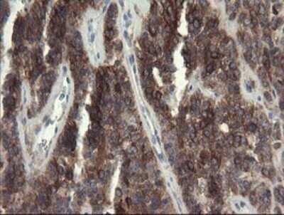 Immunohistochemistry: eIF5A2 Antibody (OTI6G7) - Azide and BSA Free [NBP2-72056]