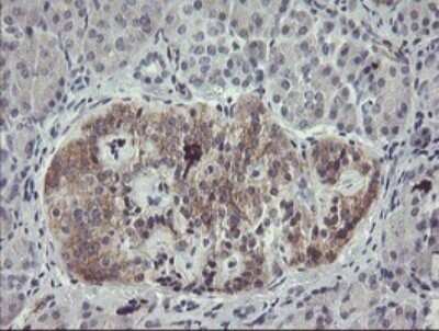 Immunohistochemistry: eIF5A2 Antibody (OTI6G7) - Azide and BSA Free [NBP2-72056]