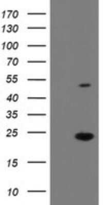 Western Blot: eIF5A2 Antibody (OTI6G7)Azide and BSA Free [NBP2-72056]