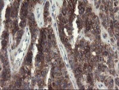 Immunohistochemistry: eIF5A2 Antibody (OTI6G7) [NBP2-45697]