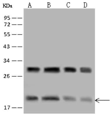 Western Blot: eIF5A2 Antibody [NBP2-96987]