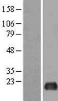 Western Blot: eIF5A2 Overexpression Lysate [NBL1-10215]