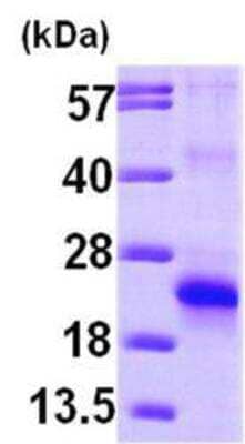 Western Blot: Recombinant Human eIF5A2 His Protein [NBP1-45261]