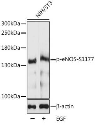 Western Blot: eNOS [p Ser1177] AntibodyAzide and BSA Free [NBP3-05432]