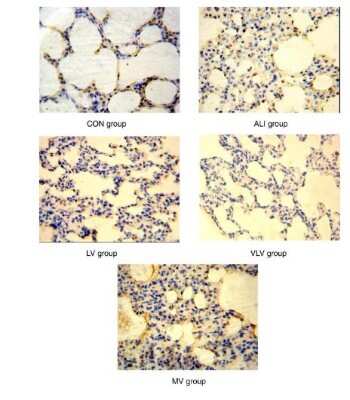 Immunohistochemistry: eNOS Antibody - BSA Free [NB300-500]