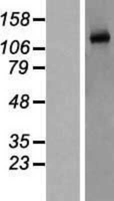 Western Blot: eNOS Overexpression Lysate [NBP2-10685]