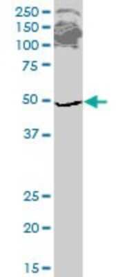 Western Blot: eRF1 Antibody (2H4) [H00002107-M02]