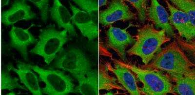 Immunocytochemistry/ Immunofluorescence: eRF1 Antibody [NBP1-31113]