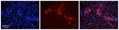 Immunohistochemistry: eRF1 Antibody [NBP1-57565]