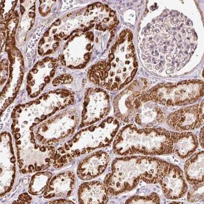 Immunohistochemistry: eRF1 Antibody [NBP2-38350]