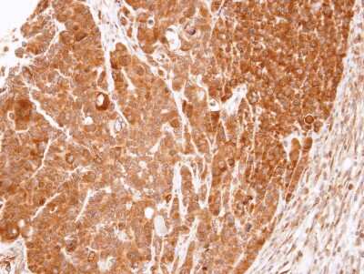 Immunohistochemistry-Paraffin: eRF1 Antibody [NBP1-31113]