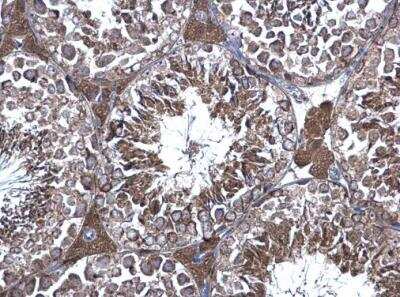 Immunohistochemistry-Paraffin: eRF1 Antibody [NBP1-31113]