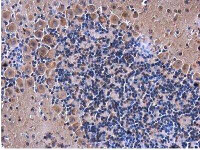 Immunohistochemistry-Paraffin: eRF1 Antibody [NBP1-31144]