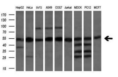 Western Blot: eRF1 Antibody (OTI2E3)Azide and BSA Free [NBP2-70692]