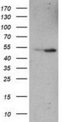 Western Blot: eRF1 Antibody (OTI2E3)Azide and BSA Free [NBP2-70692]