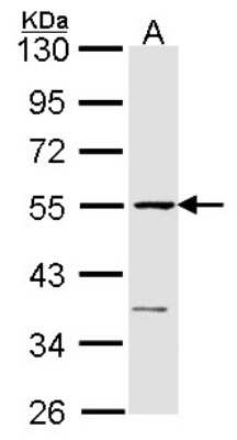 Western Blot: eRF1 Antibody [NBP1-31144]