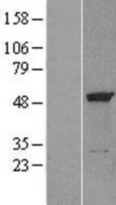 Western Blot: eRF1 Overexpression Lysate [NBL1-10348]