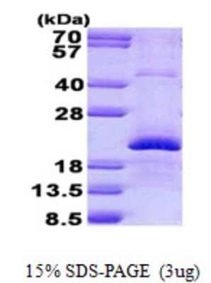 SDS-PAGE: Recombinant Human Endothelin 2 His Protein [NBP2-23022]