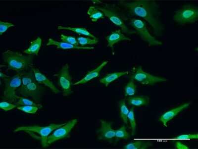 Immunocytochemistry/ Immunofluorescence: engrailed homeobox 2 Antibody (1E1) [H00002020-M03]