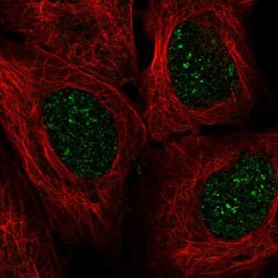 Immunocytochemistry/ Immunofluorescence: engrailed homeobox 2 Antibody [NBP2-55770]