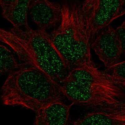 Immunocytochemistry/ Immunofluorescence: engrailed homeobox 2 Antibody [NBP2-58278]