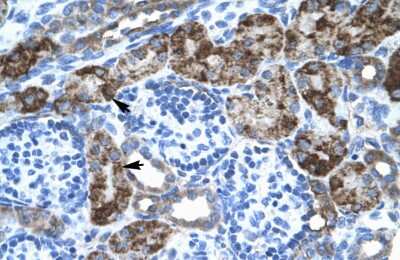 Immunohistochemistry-Paraffin: engrailed homeobox 2 Antibody [NBP3-10900]