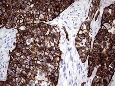 Immunohistochemistry: enkurin Antibody (OTI6C10) [NBP2-45428]