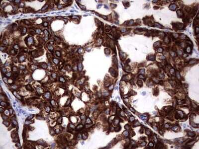 Immunohistochemistry: enkurin Antibody (OTI6C10) [NBP2-45428]