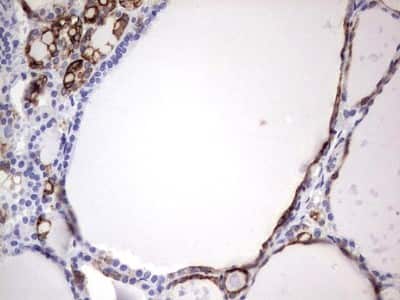 Immunohistochemistry: enkurin Antibody (OTI6C10) [NBP2-45428]