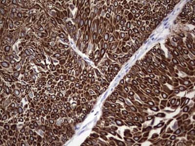 Immunohistochemistry: enkurin Antibody (OTI6C10) [NBP2-45428]