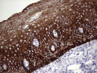 Immunohistochemistry: enkurin Antibody (OTI6C10) [NBP2-45428]