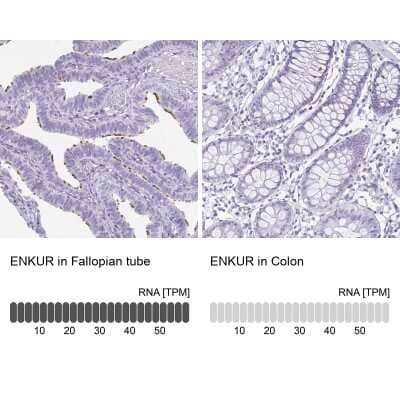 Immunohistochemistry-Paraffin: enkurin Antibody [NBP1-89911]