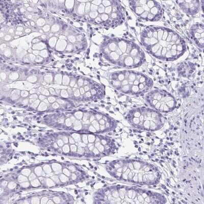 Immunohistochemistry-Paraffin: enkurin Antibody [NBP2-34037]