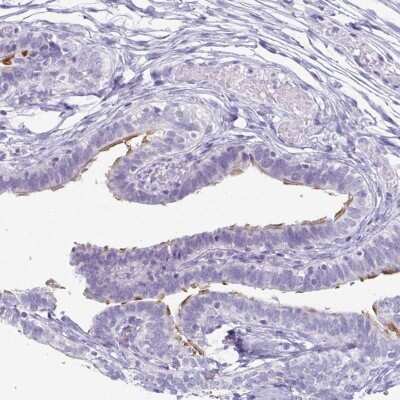 Immunohistochemistry-Paraffin: enkurin Antibody [NBP2-34037]