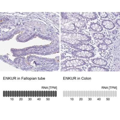 Immunohistochemistry-Paraffin: enkurin Antibody [NBP2-34037]