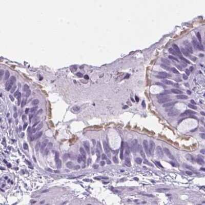 Immunohistochemistry-Paraffin: enkurin Antibody [NBP2-34037]