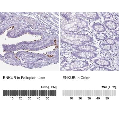 Immunohistochemistry-Paraffin: enkurin Antibody [NBP2-38925]