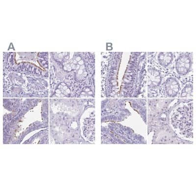 Immunohistochemistry-Paraffin: enkurin Antibody [NBP2-38925]