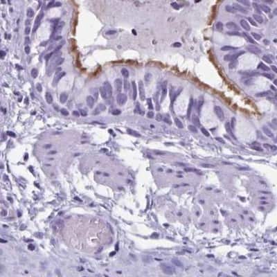 Immunohistochemistry-Paraffin: enkurin Antibody [NBP2-38925]